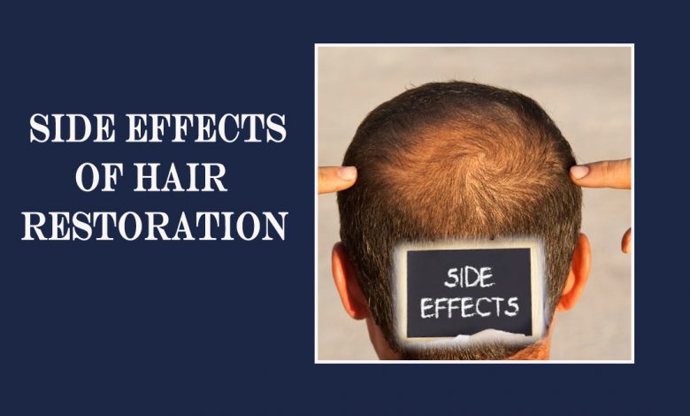 hair transplant los angeles- Most Common Side Effects of Hair Restoration