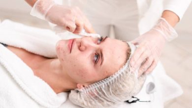 Photo of Get The Various Types Of Acne Scar Treatments In Kuala Lumpur Skin Clinics